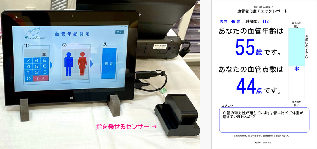 血管年齢測定機と血管老化度チェックレポート